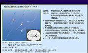 经皮穿刺（针）